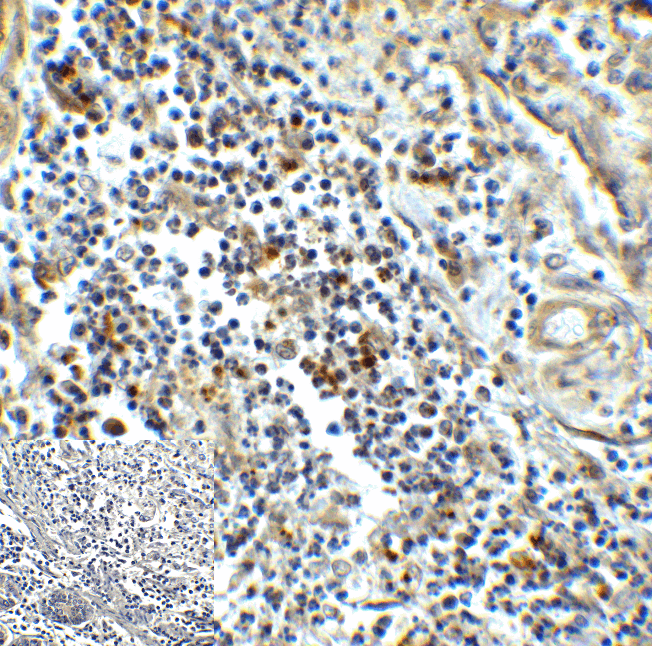 Monoclonal Mouse anti-Human HAVCR2 / TIM-3 Antibody (clone 10C10, IHC, IF, WB)
