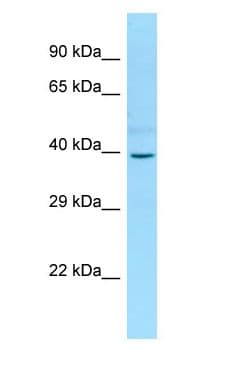 PGBD2 Antibody (aa121-170)
