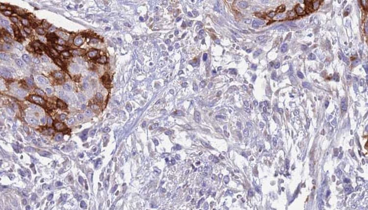 Polyclonal Rabbit anti-Human IL12RB1 / CD212 Antibody (IHC, WB)