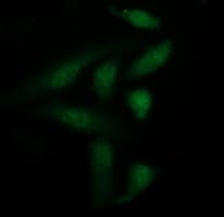 Monoclonal Mouse anti-Human LGALS3 / Galectin 3 Antibody (clone OTI1A10, IF, WB)