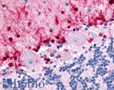 IHC-plus™ Polyclonal Rabbit anti-Human NR1D2 Antibody (Ligand-binding Domain, IHC)