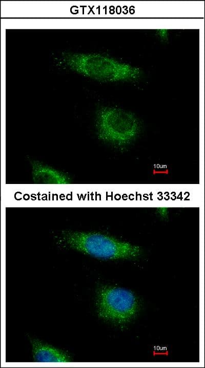 OSBPL5 Antibody (Internal)