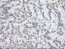 NOG / Noggin Antibody (clone OTI1C1)
