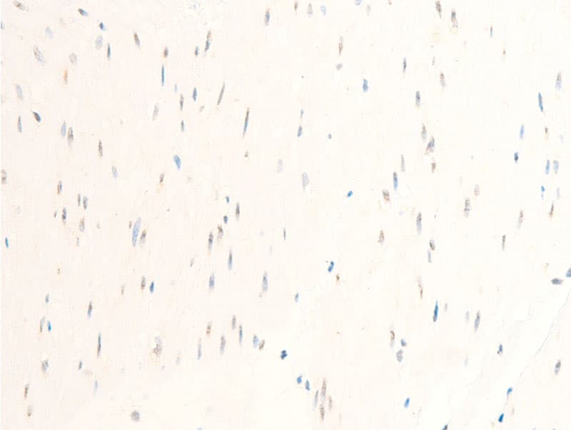 Polyclonal Rabbit anti-Human MITF Antibody (phospho-Ser180,phospho-Ser73, IHC, IF, WB)