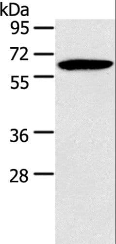 Polyclonal Rabbit anti-Human HMGCS2 / HMG-CoA Synthase 2 Antibody (IHC, WB)
