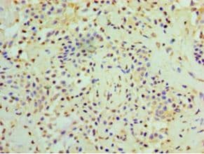RMDN3 Antibody (aa1-470, Biotin)