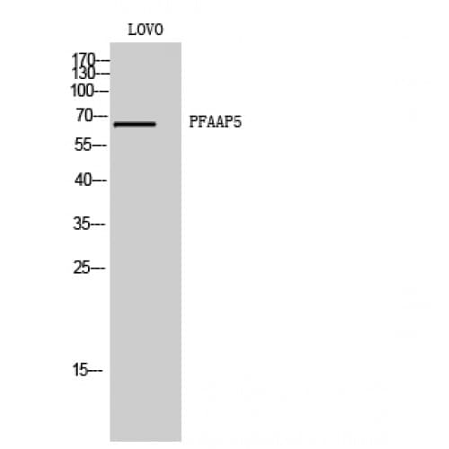 Polyclonal Rabbit anti-Human N4BP2L2 Antibody (330-410 aa, Internal, WB)