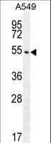 CIART / C1orf51 Antibody (aa18-47)