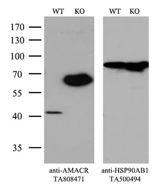 AMACR / P504S Antibody (clone OTI3H10)
