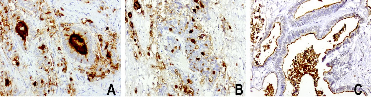 EMA / MUC1 Antibody (clone UMAB57, Carrier-free)