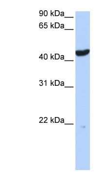 KRT23 / Keratin 23 Antibody (C-Terminus)