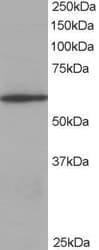 PathPlus™ Polyclonal Goat anti-Human CORO1A / Coronin 1a Antibody (aa546-558, IHC, WB)