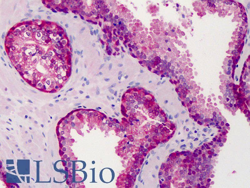 IHC-plus™ Polyclonal Goat anti-Human COMT Antibody (aa52-65, IHC, WB)