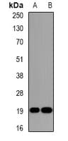 Polyclonal Rabbit anti-Human DR1 / NC2 Antibody (IHC, WB)