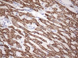 OTC Antibody (aa33-354, clone OTI4G4)