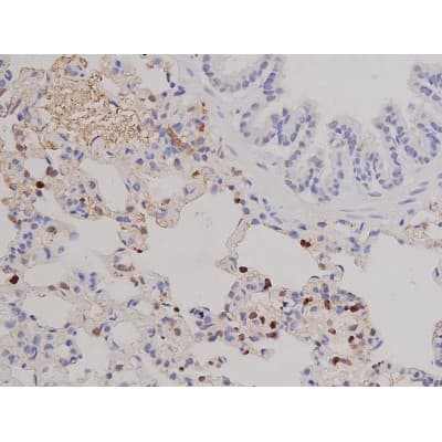 FAK / Focal Adhesion Kinase Antibody (phospho-Tyr576)