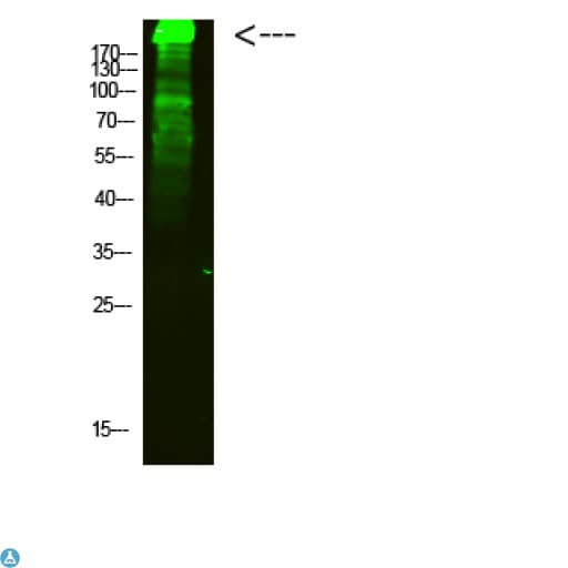 MYHC / MYH6 Antibody