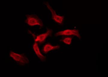 GPCRW / GPR18 Antibody