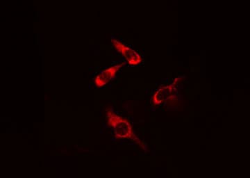 CARMA1 / CARD11 Antibody