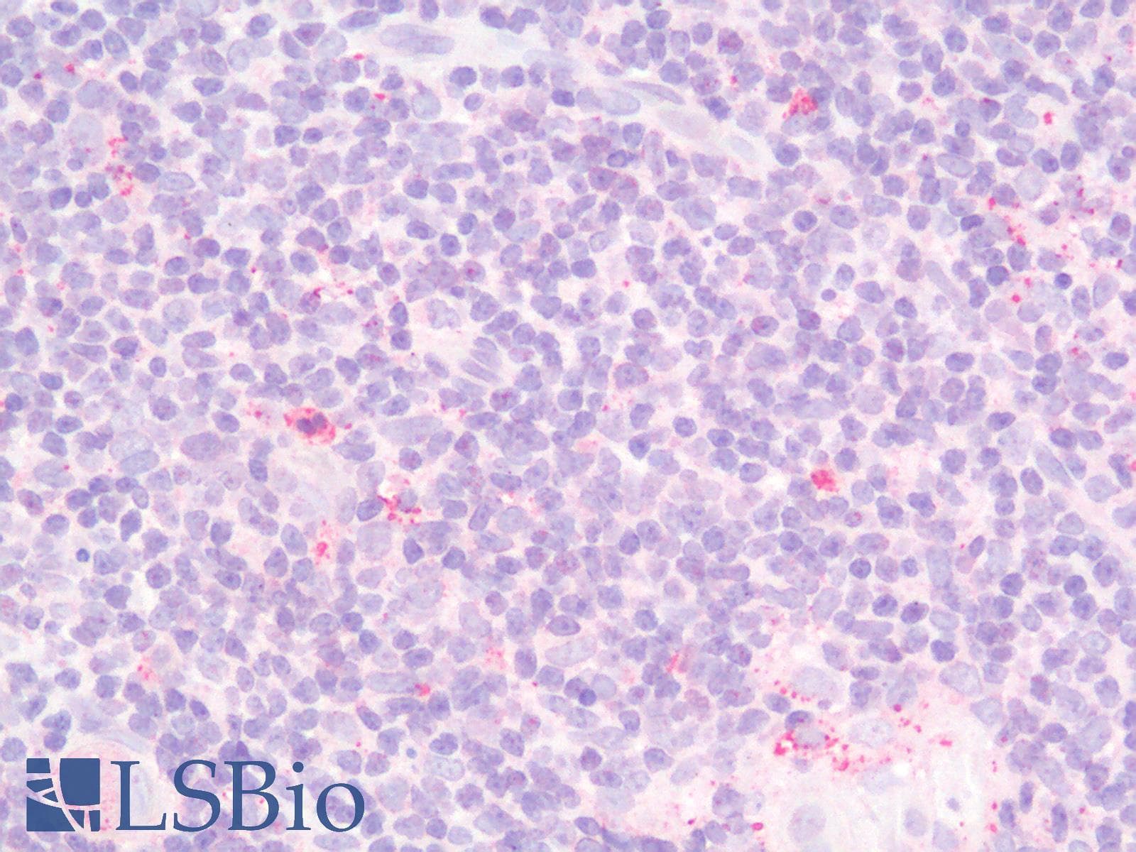 IHC-plus™ IL23A / IL-23 p19 Antibody
