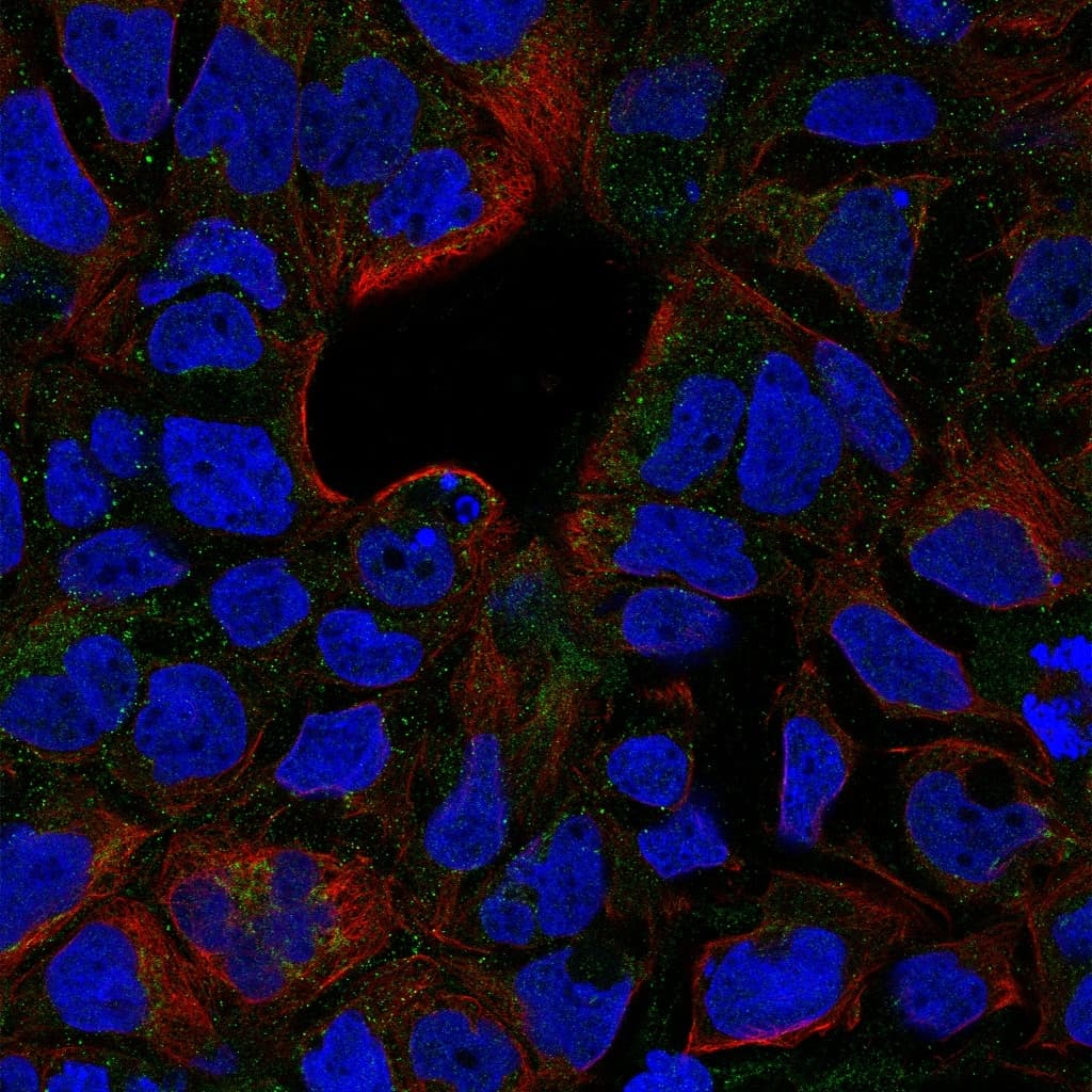 TNFRSF1B / TNFR2 Antibody
