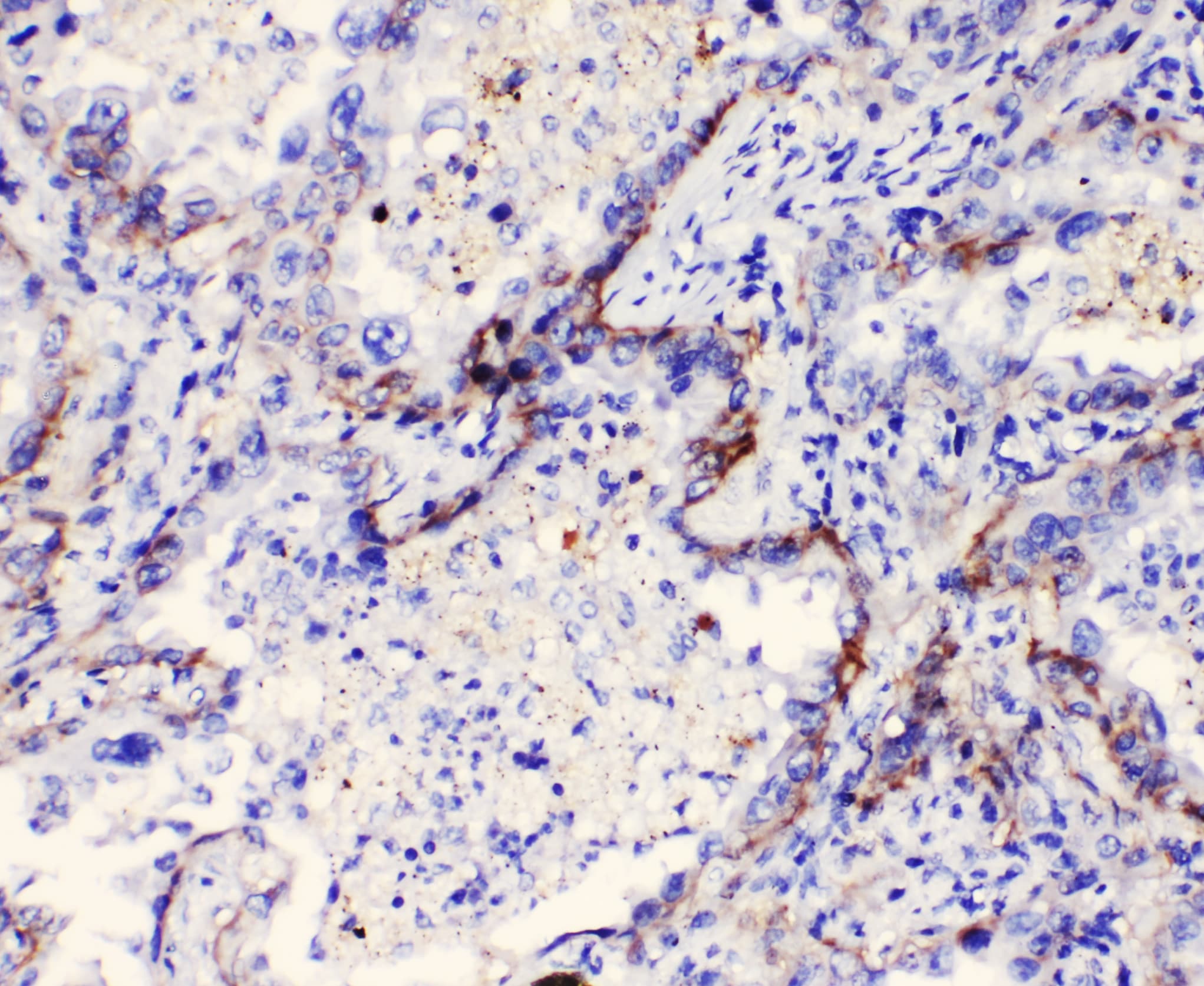 Polyclonal Rabbit anti-Human ITGA3 / CD49c Antibody (IHC, WB)