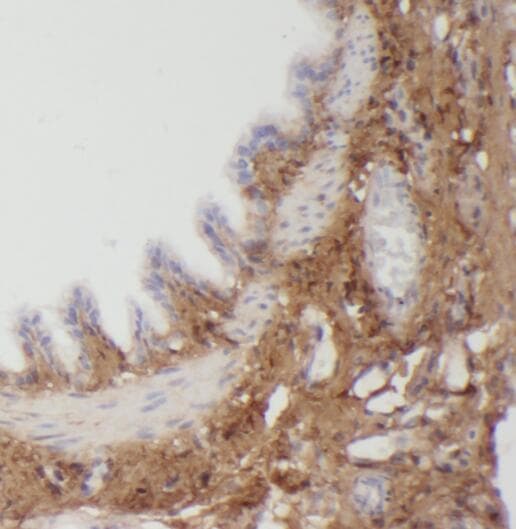 PLEKHO2 Antibody