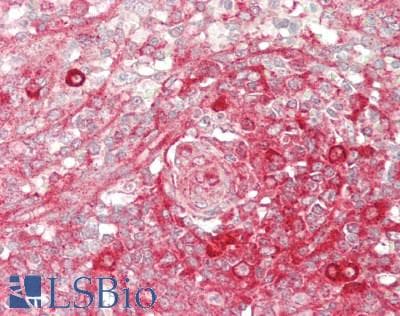 IHC-plus™ AARS Antibody (aa775-825)