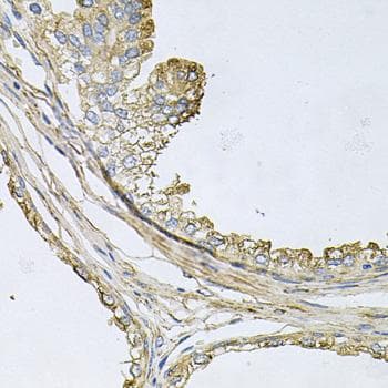 Polyclonal Rabbit anti-Human APOE / Apolipoprotein E Antibody (IHC)