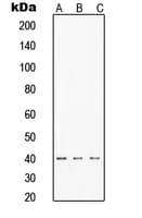 TINF2 Antibody (Internal)
