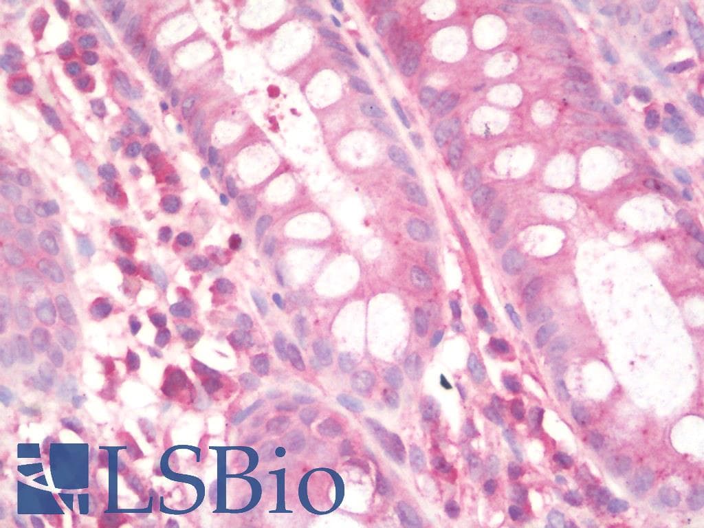 IHC-plus™ Polyclonal Rabbit anti-Human SUZ12 Antibody (IHC, IF, WB)