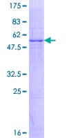 Human GK5 Protein (Recombinant GST)