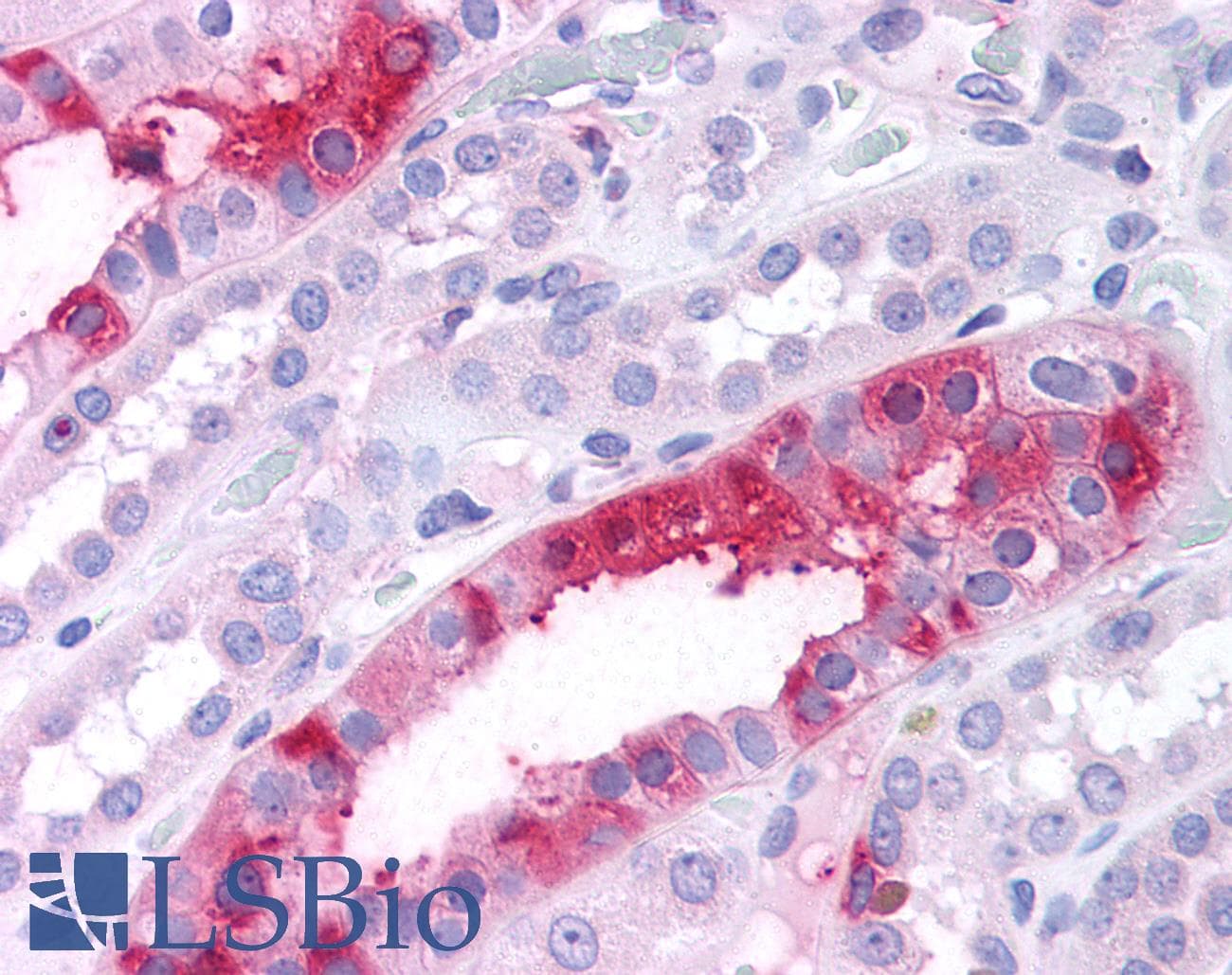 IHC-plus™ Polyclonal Rabbit anti-Human SGK3 Antibody (N-Terminus, IHC)