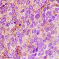 NAK / TBK1 Antibody