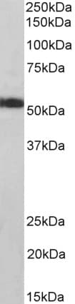 IHC-plus™ Polyclonal Goat anti-Human ATP5A1 / ATP Synthase Alpha Antibody (aa83-94, IHC, WB)