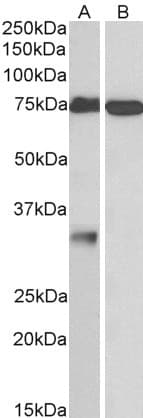 IHC-plus™ Polyclonal Goat anti-Human GPM6A / Glycoprotein M6A Antibody (aa59-70, IHC, WB)