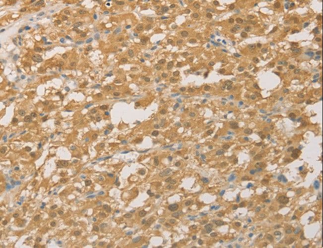 PGK2 Antibody