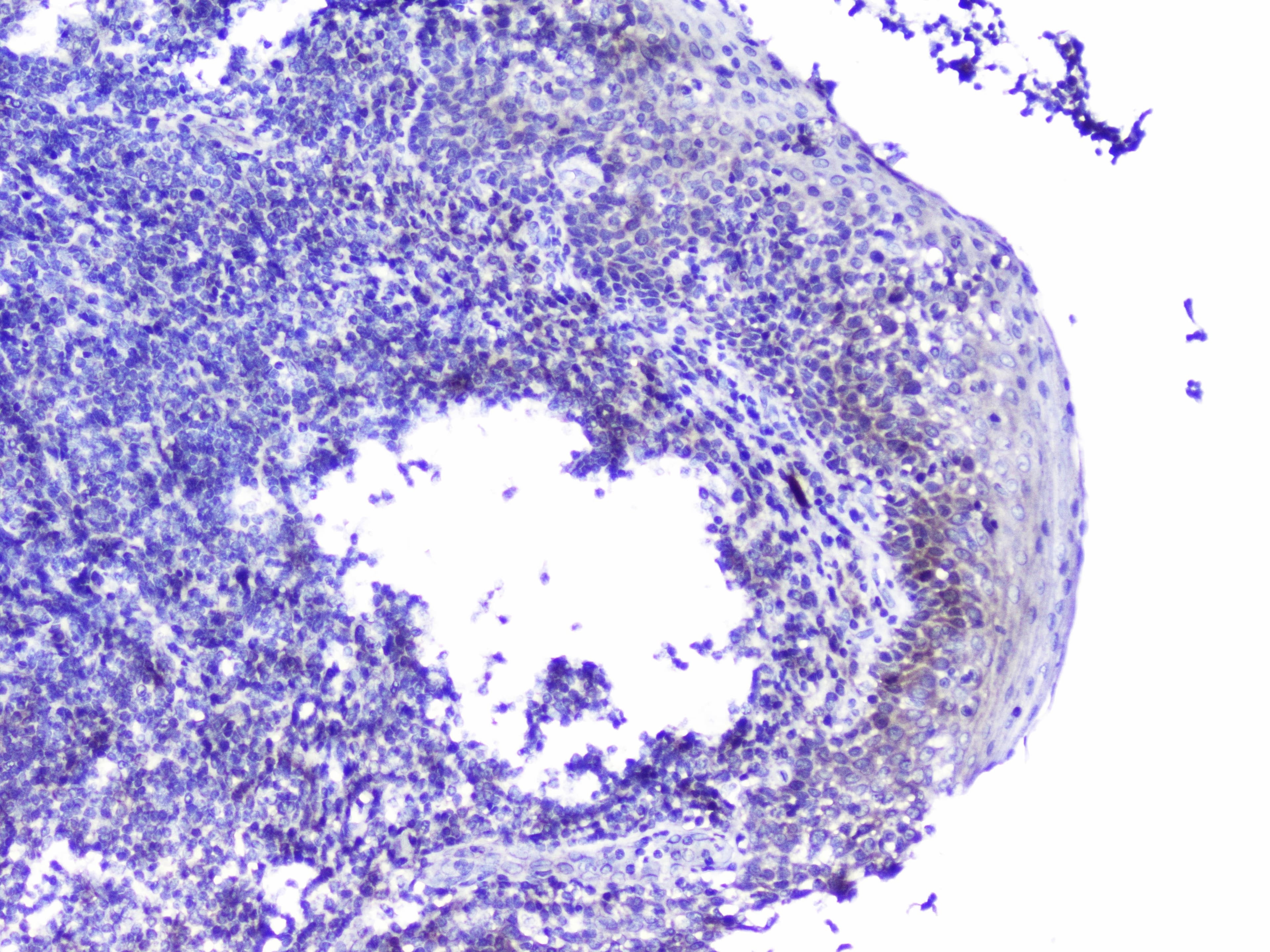 Polyclonal Rabbit anti-Human CDK6 Antibody (WB)