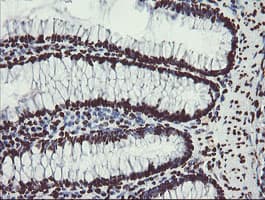 NONO / P54NRB Antibody (aa184-385, clone OTI5F1)