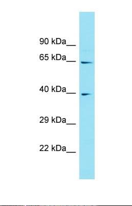 ABHD17C / FAM108C1 Antibody (aa156-205)