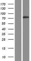 SPIRE1 Protein (Over-Expression Lysate Myc-DDK (Flag))