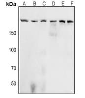 ACIN1 / Acinus Antibody
