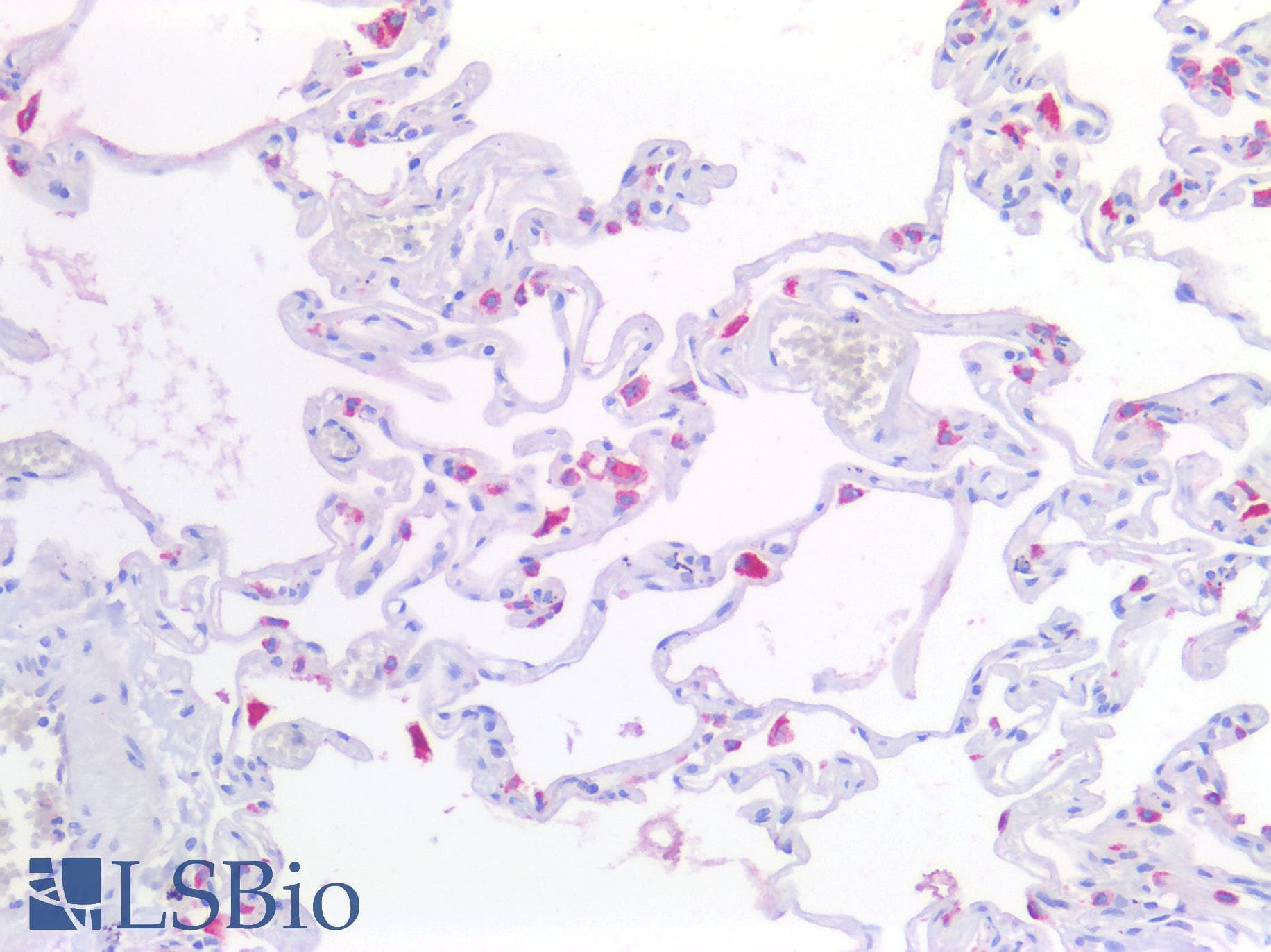 IHC-plus™ Polyclonal Rabbit anti-Human NAPSA / NAPA / Napsin A Antibody (IHC)