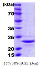 Human IL1A / IL-1 Alpha Protein (Recombinant His)