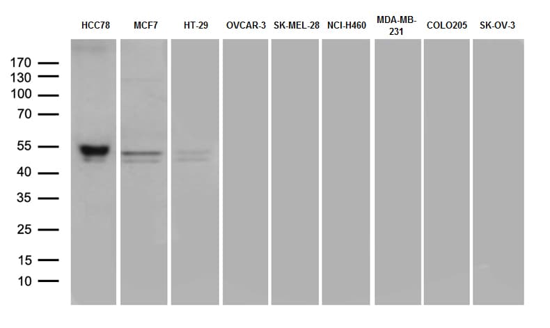 CD274 / B7-H1 / PD-L1 Antibody (aa19-290, clone OTI12G7)