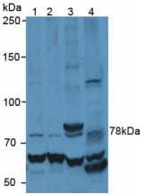 MMP9 / Gelatinase B Antibody (aa226-391)