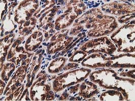 ERGIC-53 / LMAN1 Antibody (clone OTI1A8)
