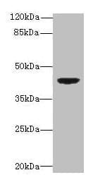 DAPK2 / DAP Kinase 2 Antibody (aa222-370)