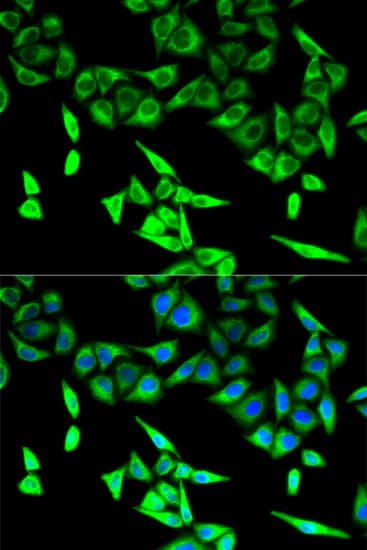 IHC-plus™ HADHA Antibody