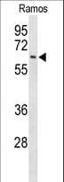 Polyclonal Rabbit anti-Human EIF2A / EIF2 Alpha Antibody (aa437-465, IHC, WB)